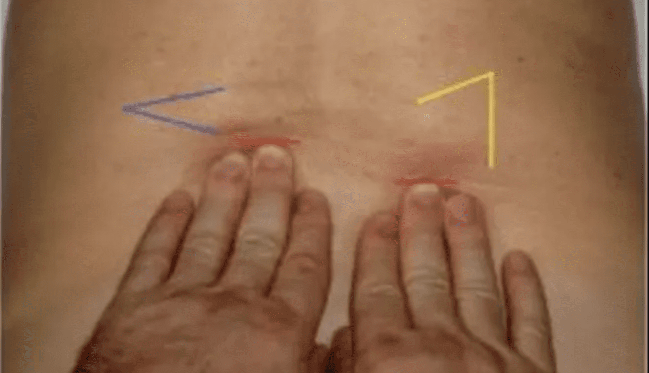 Medical Massage Therapist Vs Relaxation Massage